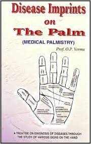 Disease Imprints on The Palm